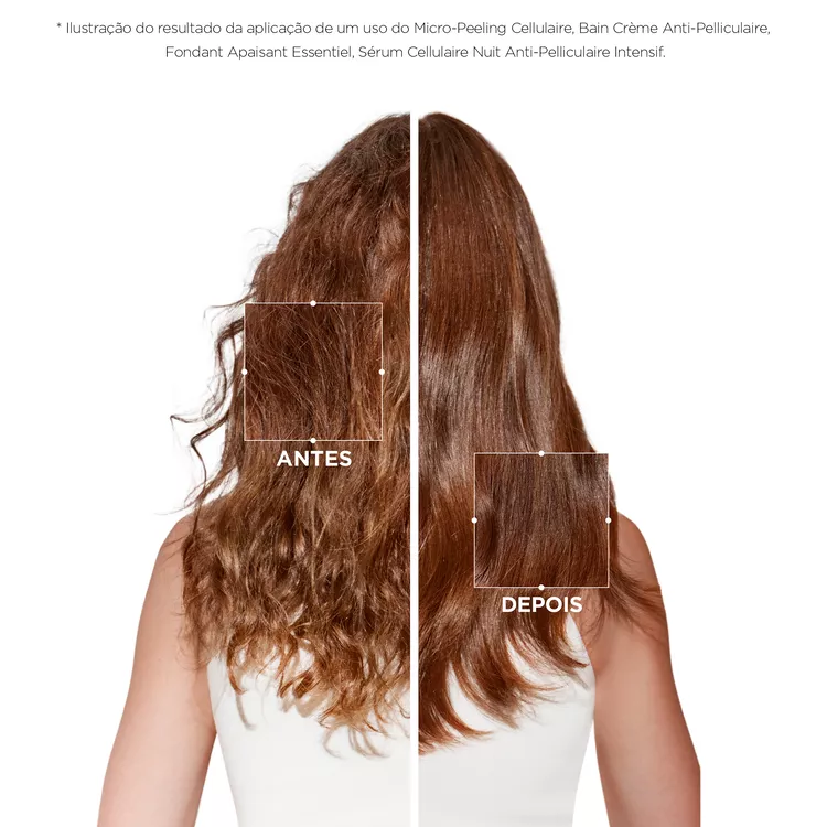 Cabelos com caspa antes e depois
