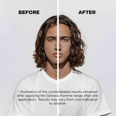 Reduz a queda de cabelo em 6 semanas