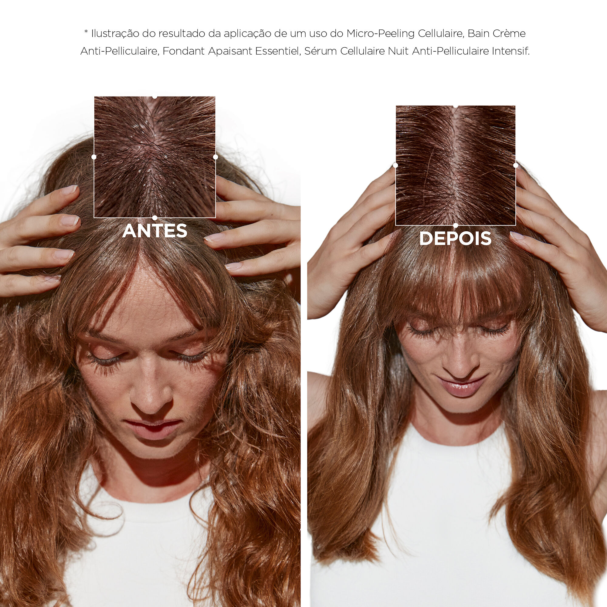 Micro-Peeling Kerastase Symbiose Cellulaire antes e depois do uso