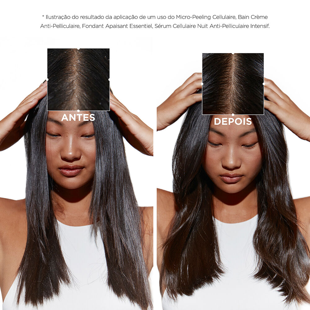 Shampoo Kerastase Symbiose Bain Purete Anti-Pelliculaire antes e depois do uso