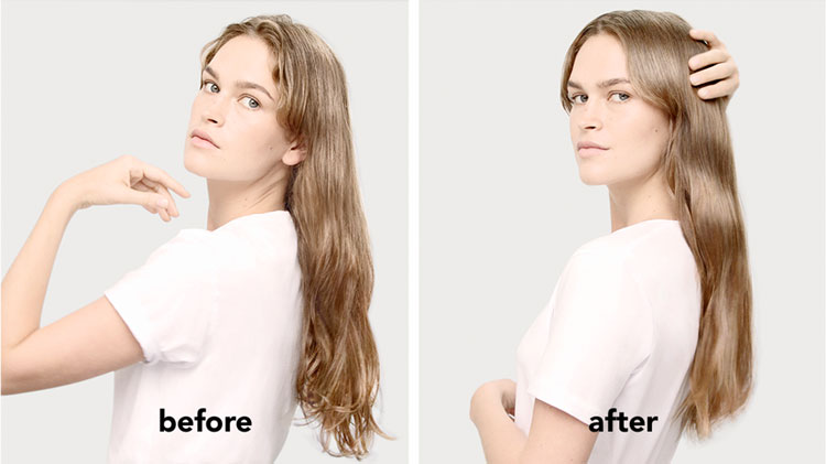 Injeção de reconstrução Antes e depois da injeção de Reconstrução Fusio Dose