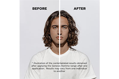 Melhores produtos para queda de cabelo masculino antes e depois