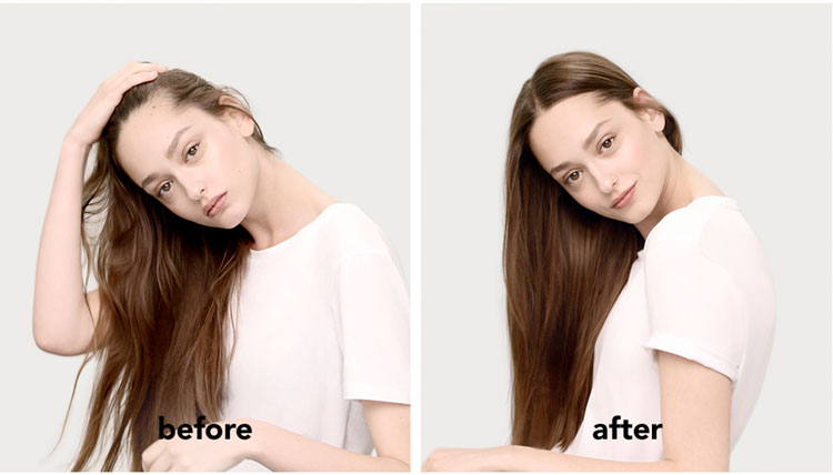 Injeção de nutrição Antes e depois da injeção de nutrição Fusio Dose
